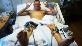 How NOT To Ride A Dirtbike 2017